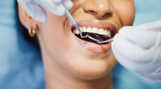 Best Emergency Treatment for Dental Infections or Abscesses in Mowbray Mountain, TN